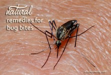 Natural Remedies for Bug Bites | Eco-Mothering.com